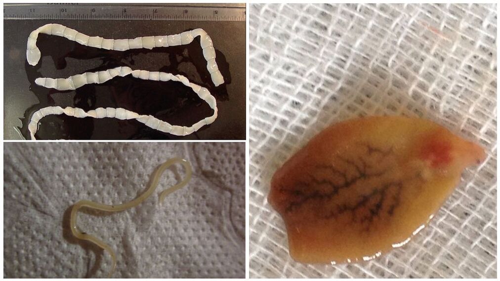 A paraziták fajtái