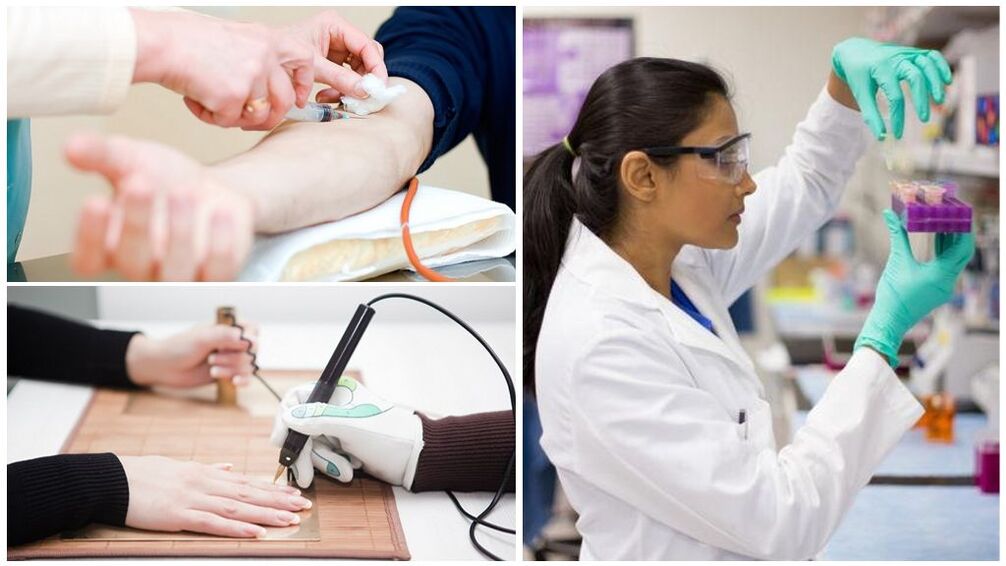 Diagnosztikai módszerek a paraziták kimutatására a szervezetben