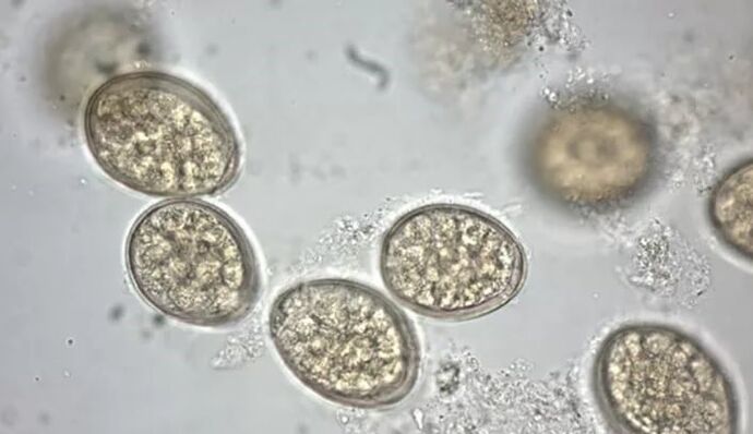 paraziták mikroszkóp alatt