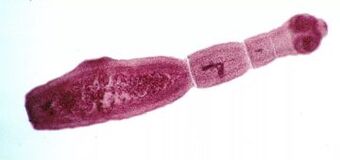 Hogyan lehet megszabadulni az emberi test parazitáitól