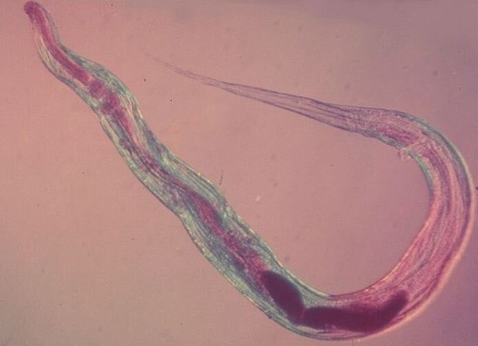 Pinworm mikroszkóp alatt