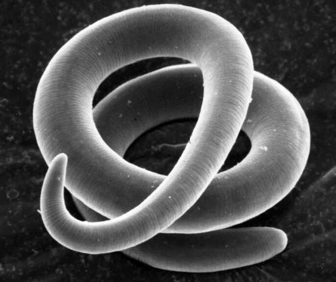 Trichinella mikroszkóp alatt